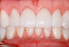 Dental Images 07860