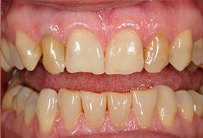 Dental Photos 07860