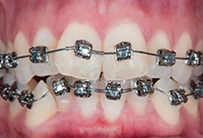 Dental Photos in Newton