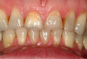07860 Dental Images